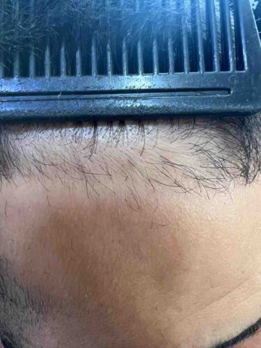 سرم و روغن مو زنانه – مردانه کراستاز اورجینال 3474636356010 photo review